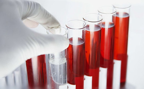 Анализ крови — быстрый и эффективный способ диагностики.